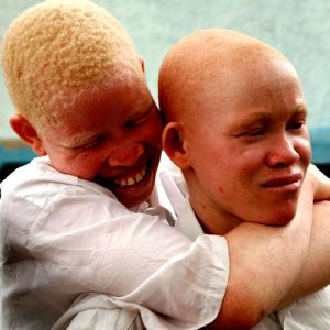 On estime que plus de 150.000 albinos vivent en Tanzanie; un certain nombre d'albinos ont fui vers la région de Dar es Salaam  (Maison de la Paix ou Havre de Paix) la plus grande ville de Tanzanie, parce qu’ils se sentent plus en sécurité dans un milieu urbain. On pense que la Tanzanie possède la plus grande population d'albinos en Afrique.